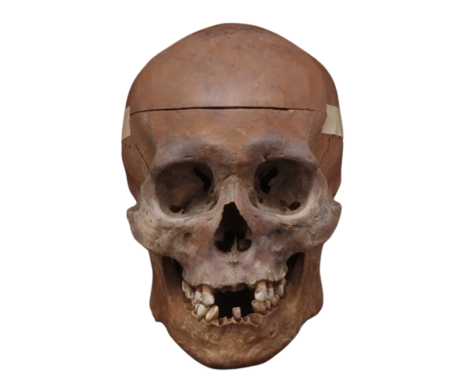 青谷上寺地遺跡8号人骨(男性)